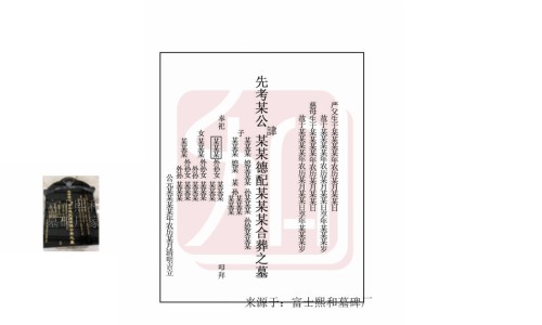 脾有点痛要当心了-脾疼痛消化不好怎么办网 - 网站提供脾疼痛消化不好怎么办吃什么药小常识、脾疼痛消化不好怎么办缓解